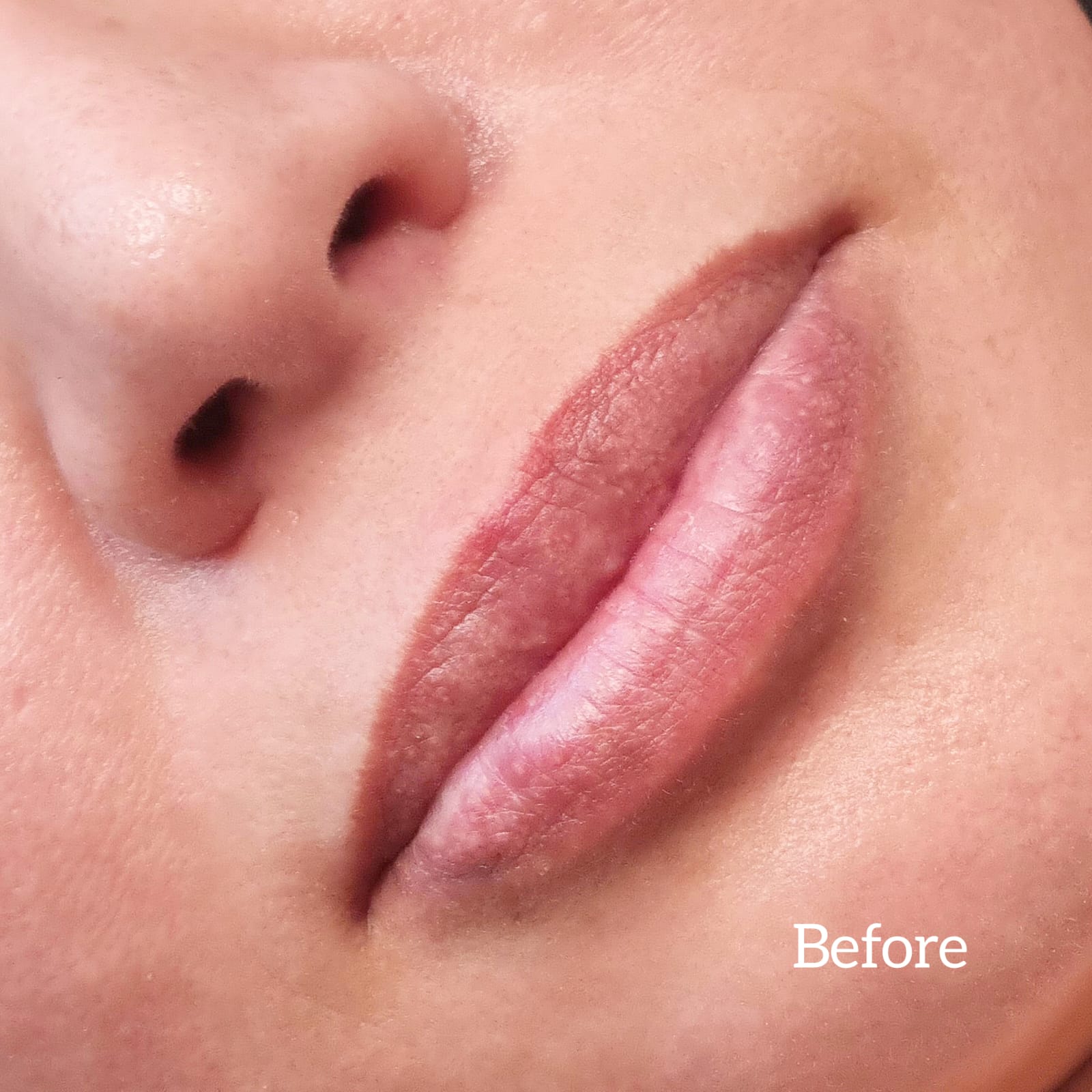 Voor: Permanente Lip Make-up